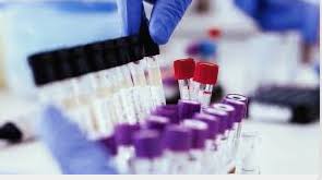 Mandatory Drug Testing for Public Service Applicants